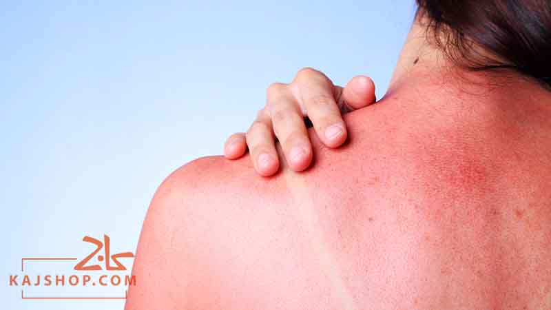 مهم ترین ویژگی محصولات ضد آفتاب